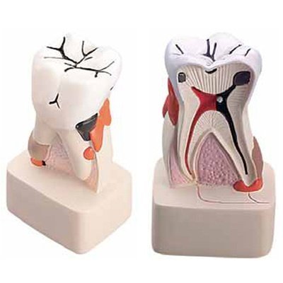 Dental-Pathology-Model.jpg