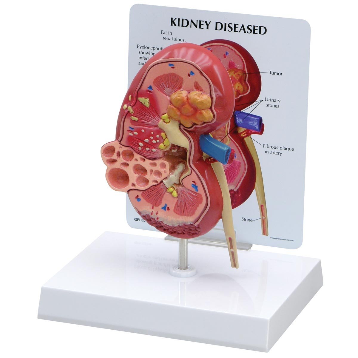 Human-Pathology-Models.jpg Human Pathology Models