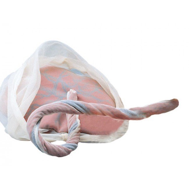 Model-of-Placenta-Umbilical-Cord.jpg Model of Placenta – Umbilical Cord