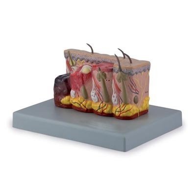 Pathological-Model-Of-Burned-Skin.jpg